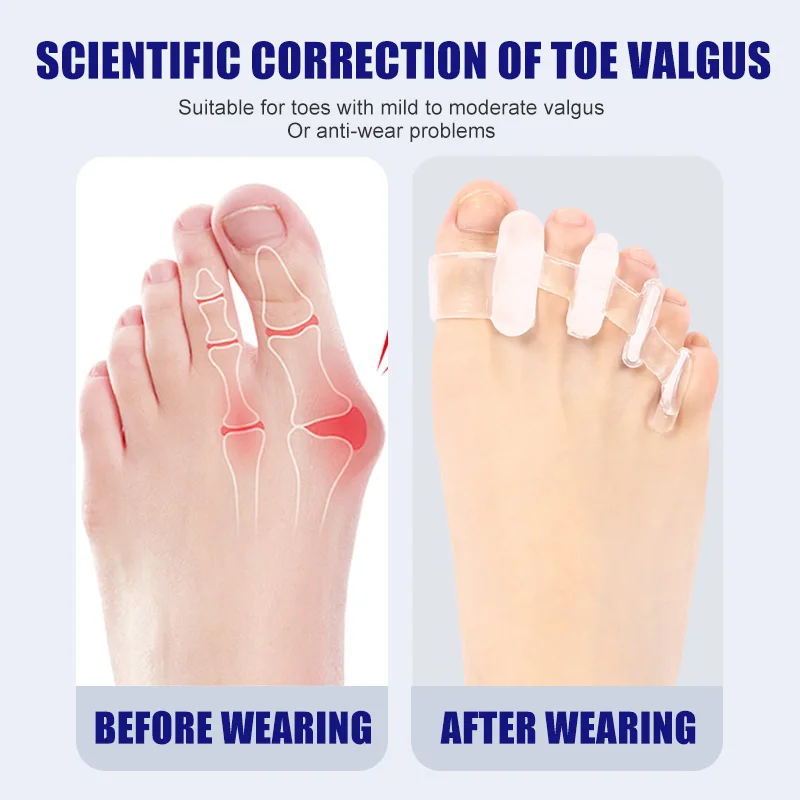 1 Pair Silicone Toe Separator  - огляд і ціна Toe Separator Silicon
