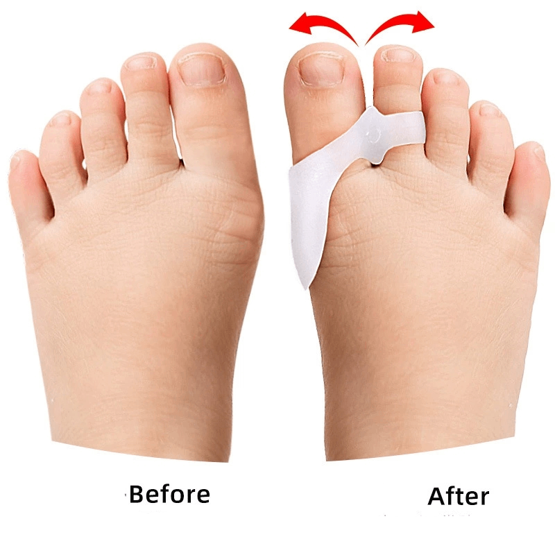 1/2/3Pairs Children's Gel Toe  - огляд і ціна Toe Separator Silicon