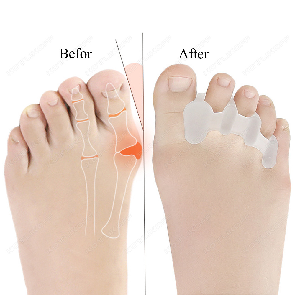 Toe Protective Toes Separator  - огляд і ціна Toe Separator Silicon