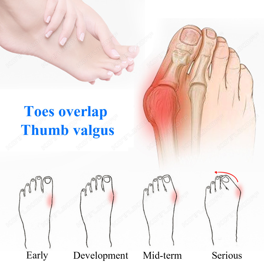 Toe Protective Toes Separator  - огляд і ціна Toe Separator Silicon