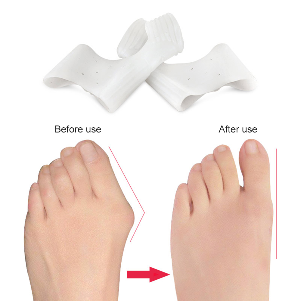 1Pair Silicone Bunion Correcto - огляд і ціна Toe Separator Silicon