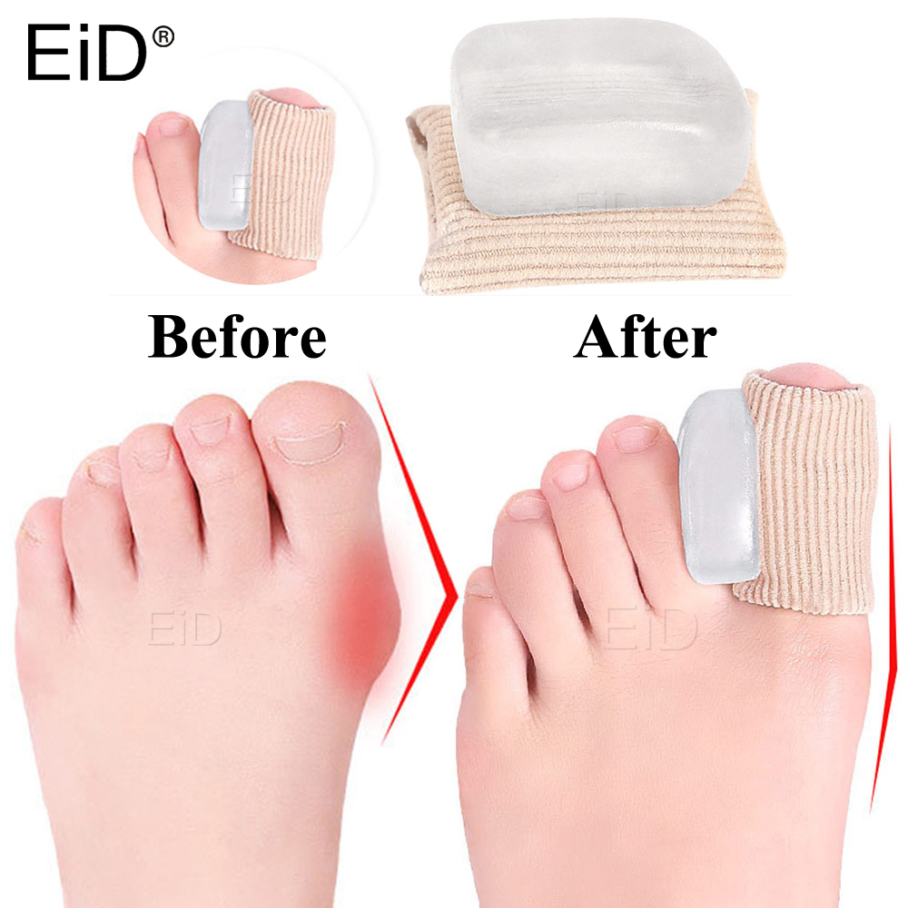 2 PCS Silicone Gel Thumb Corre - огляд і ціна Toe Separator Silicon