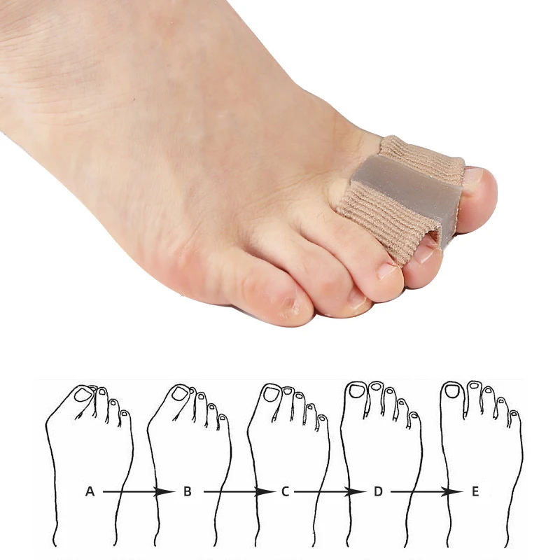 Gel Bunion Toe Separators W/Fa - огляд і ціна Toe Separator Silicon